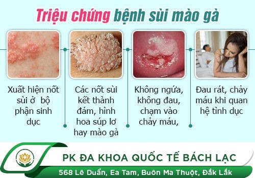 Cách nhận biết sớm biểu hiện sùi mào gà