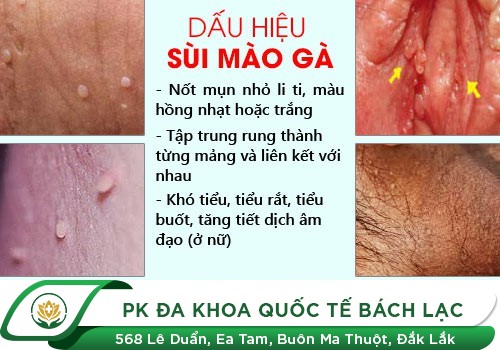 nguyên nhân khiến dương vật có mùi hôi ở quý ông