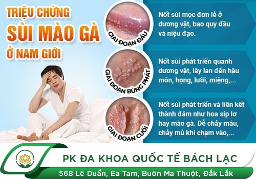 Dương vật nổi mụn thịt dấu hiệu bệnh lý nguy hiểm