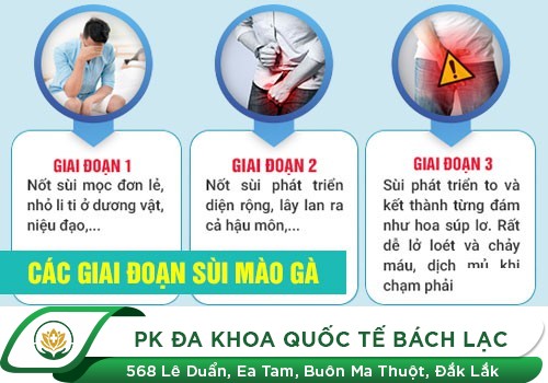 Triệu chứng điển hình của bệnh sùi mào gà ở dương vật