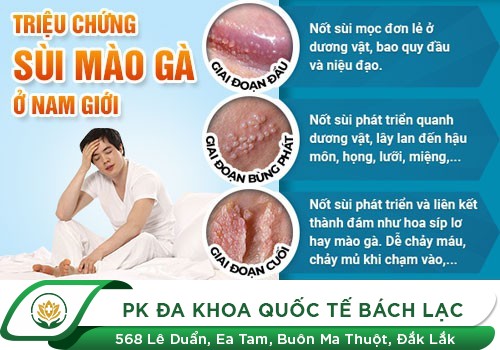 Nổi mụn nhọt ở dương vật là triệu chứng bệnh gì?