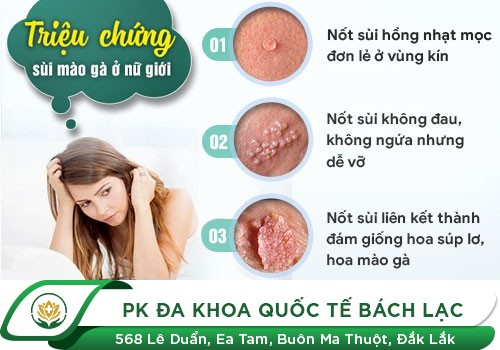Những hình ảnh bệnh sùi mào gà ở nữ