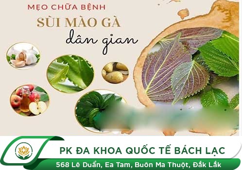 Một số cách chữa sùi mào gà được nhiều người áp dụng