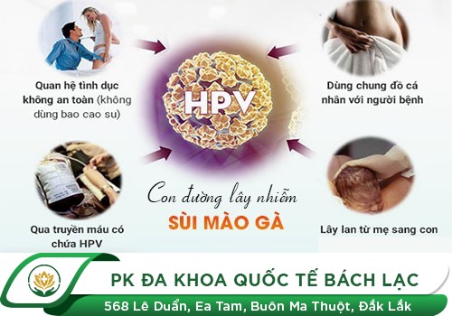 Bệnh sùi mào gà lây truyền như thế nào?