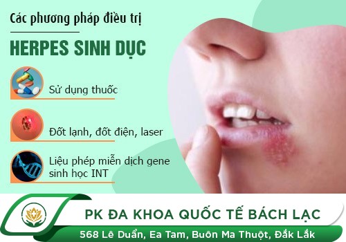 HỖ TRỢ ĐIỀU TRỊ GAI Ở CƠ QUAN SINH DỤC NHƯ THẾ NÀO?