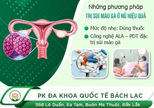 Địa chỉ điều trị sùi mào gà uy tín tại Đắk Lắk