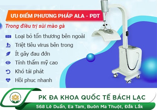 Phương pháp điều trị condyloma