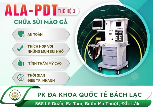 Phương pháp chữa sùi mào gà hiệu quả bằng công nghệ mới