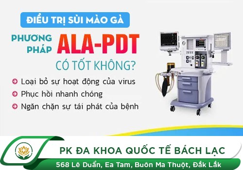 Cách Chữa Bệnh Sùi Mào Gà Hiệu Quả Và Hạn Chế Tái Phát