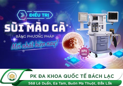 Điều trị sùi mào gà