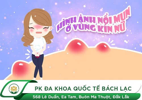 Nổi mụn ở môi lớn, môi bé âm đạo
