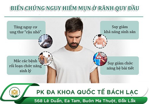Mụn thịt dương vật là bệnh gì?