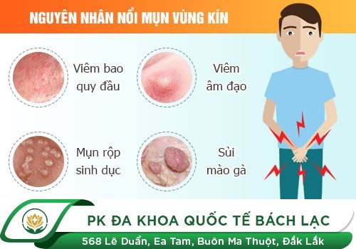 nổi ghẻ ở dương vật 