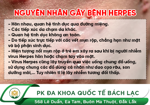 Bệnh Herpes sinh dục là gì?