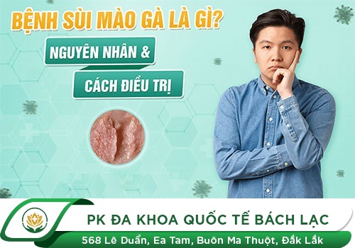 ĐỊA CHỈ HỖ TRỢ ĐIỀU TRỊ SÙI MÀO GÀ BẰNG PHƯƠNG PHÁP ALA – PDT HIỆU QUẢ