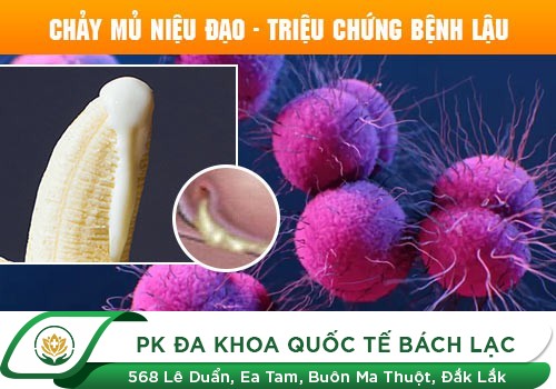 BỆNH LẬU LÀ GÌ?
