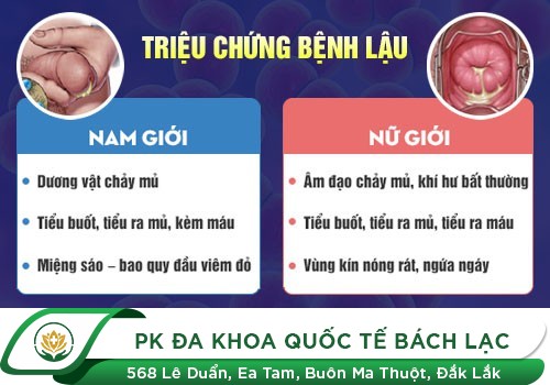 TIỂU RA MỦ ­- DẤU HIỆU NHẬN BIẾT CỦA BỆNH LẬU