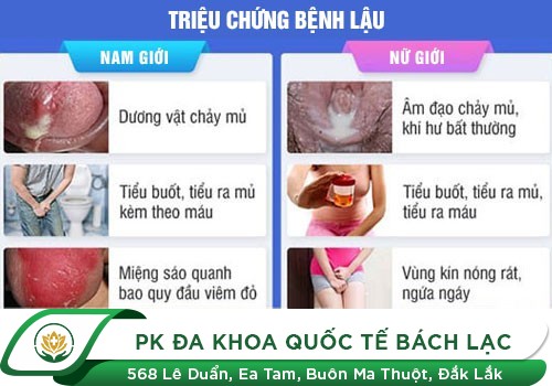 Biểu hiện của bệnh lậu mãn tính