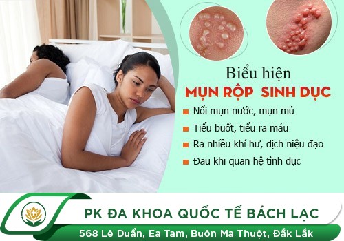 Mụn rộp sinh dục