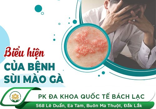 Nhận biết triệu chứng sùi mào gà ở cổ tử cung