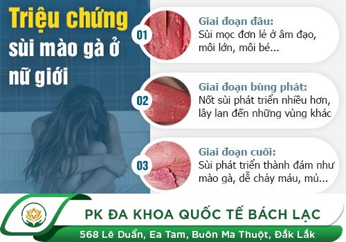 Môi nhỏ sần sùi là bệnh gì?
