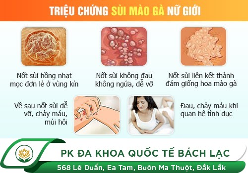 Biểu hiện sùi mào gà ở nữ giới