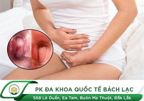Viêm cổ tử cung
