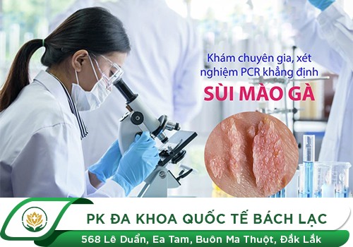 Vì sao nên đi xét nghiệm sùi mào gà? Xét nghiệm sùi mào gà khi nào?