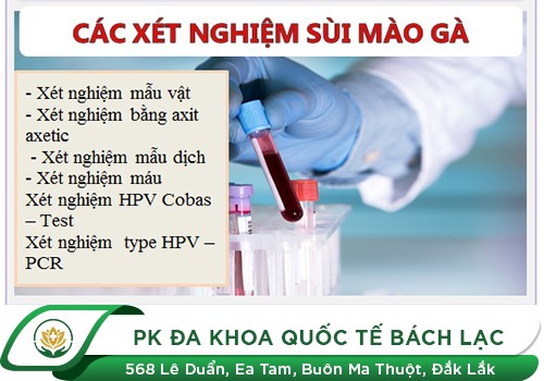 Phương pháp xét nghiệm sùi mào gà