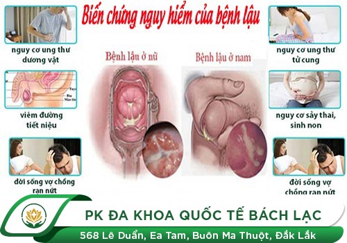 Dương vật chảy dịch, chảy mủ nguy hiểm ra sao?