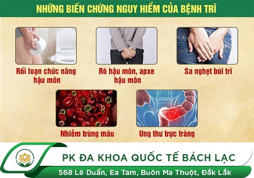 Tác Hại Khủng Khiếp Trĩ Hỗn Hợp Cần Chữa Ngay