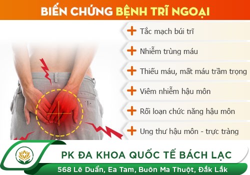 Bệnh trĩ ngoại có nguy hiểm không?