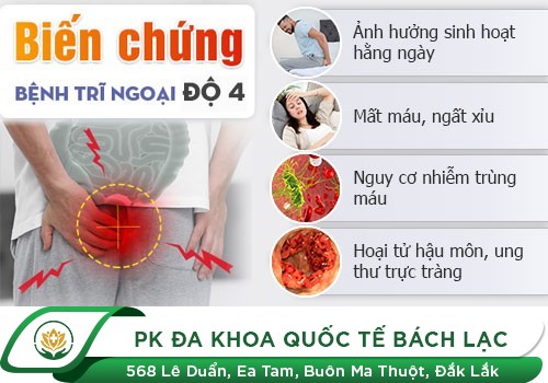 Tác hại đáng sợ nếu coi thường bệnh trĩ ngoại
