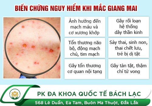 Hình Ảnh Thực Tế Của Bệnh Giang Mai