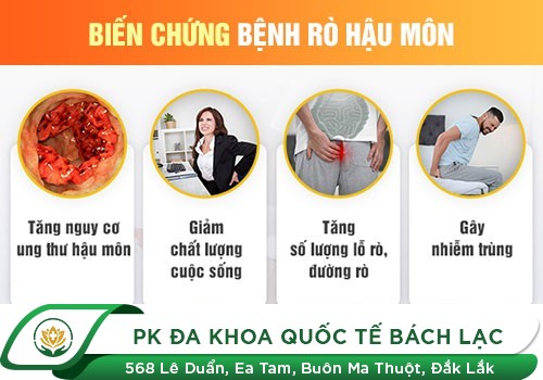 Rò Hậu Môn Có Nguy Hiểm Không? Điều Trị Thế Nào Tránh Biến Chứng