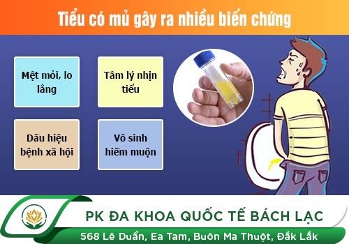 Bạn Biết Gì Về Tình Trạng Tiểu Ra Mủ