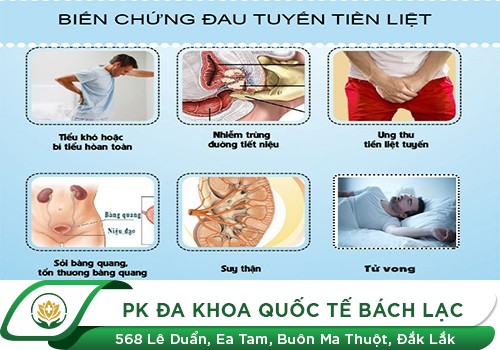 Những Dấu Hiệu Của Bệnh Viêm Tuyến Tiền Liệt