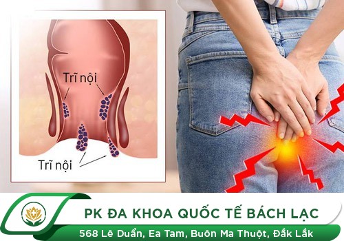 CẢNH BÁO TÁC HẠI NGUY HIỂM KHI BỊ TRĨ NỘI