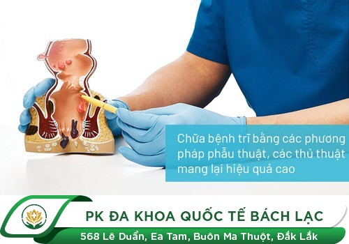 Hậu Môn Bị Lòi Thịt Dư Gây Đau Rát