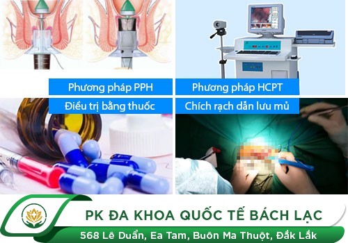 Chữa Bệnh Trĩ Nội Không Còn Là Nỗi Lo