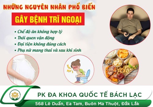 Phương Pháp Điều Trị Bệnh Trĩ Ngoại Hiệu Quả Nhất Hiện Nay