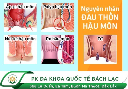 Hậu Môn Bị Ngứa Và Sưng Là Bị Gì?