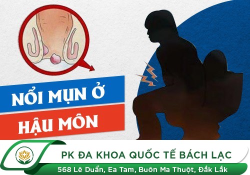 Nổi Mụn Hậu Môn Là Bệnh Gì? Có Nguy Hiểm Không?