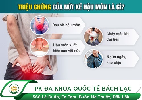Nứt kẽ hậu môn