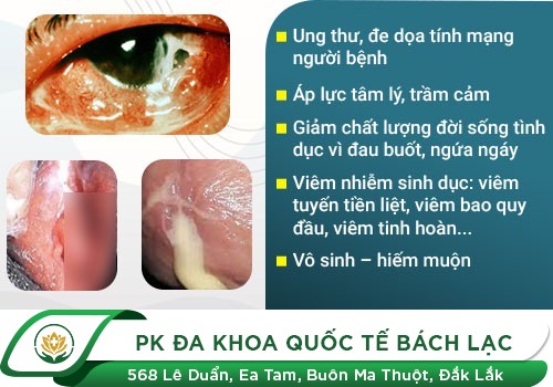 Các Dấu Hiệu Bệnh Lậu Bệnh Nhân Cần Lưu Ý