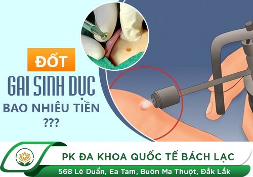 Gai Sinh Dục Nam Có Nguy Hiểm Không?