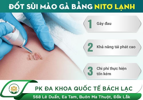 Có Nên Đốt Sùi Mào Gà Bằng Điện Và Laser
