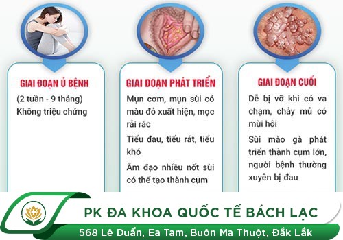 Khám Bệnh Sùi Mào Gà Ở Đâu Đắk Lắk?
