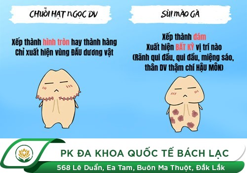 Hạt Ngọc Dương Vật Có Phải Sùi Mào Gà Không