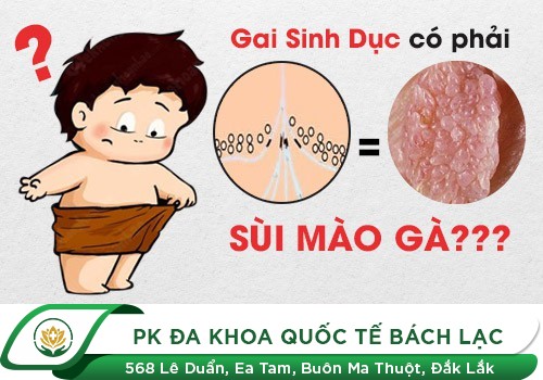 Gai Sinh Dục Có Gì Khác Với Sùi Mào Gà